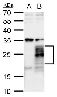 Anti-FGF18 antibody used in Western blot. GTX128496