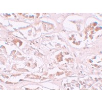 Anti-ALKBH2 antibody used in Immunohistochemistry. GTX85166