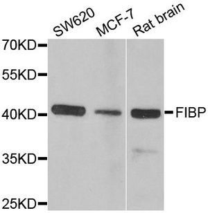 Anti-FIBP antibody used in Western blot. GTX53989