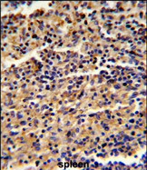 Anti-ALKBH8 antibody, C-term used in IHC (Formalin-fixed paraffin-embedded sections). GTX81711