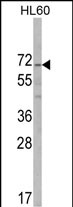 Anti-ALKBH8 antibody, C-term used in Western blot. GTX81711