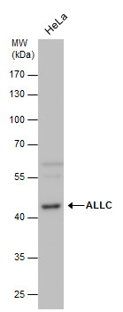 Anti-ALLC antibody used in Western blot. GTX120709
