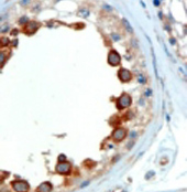 Anti-ALMS1 antibody used in IHC (Formalin-fixed paraffin-embedded sections). GTX24306