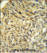 Anti-FKBP14 antibody, N-term used in IHC (Formalin-fixed paraffin-embedded sections). GTX81835