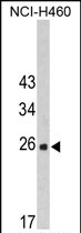 Anti-FKBP14 antibody, N-term used in Western blot. GTX81835