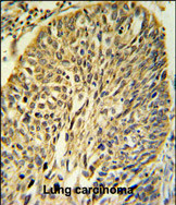 Anti-FKBP9 antibody, C-term used in IHC (Formalin-fixed paraffin-embedded sections). GTX81479
