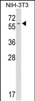 Anti-FKBP9 antibody, C-term used in Western blot. GTX81479