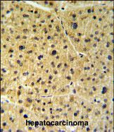 Anti-FKBP9 antibody, N-term used in IHC (Formalin-fixed paraffin-embedded sections). GTX81480
