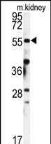 Anti-FKBP9 antibody, N-term used in Western blot. GTX81480