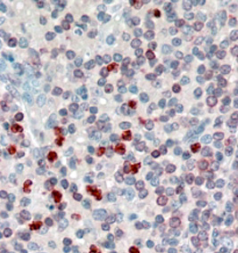 Anti-FLAP / ALOX5AP antibody, Internal used in IHC (Formalin-fixed paraffin-embedded sections). GTX89246
