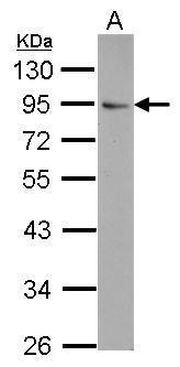 Anti-FLYWCH1 antibody used in Western blot. GTX116956