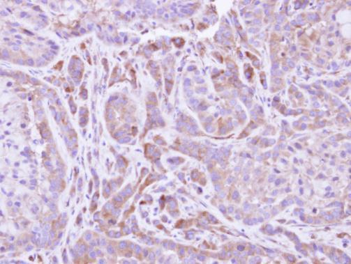 Anti-FMO2 antibody [N1C2] used in IHC (Formalin-fixed paraffin-embedded sections). GTX109907