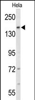 Anti-FNDC3B antibody, N-term used in Western blot. GTX81041
