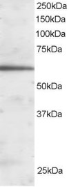 Anti-FOXA2 antibody, C-term used in Western blot. GTX25074