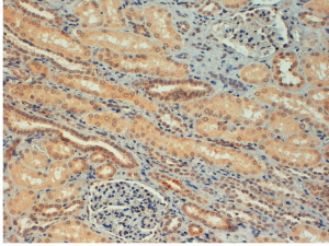 Anti-FOXC1 antibody, C-term used in IHC (Formalin-fixed paraffin-embedded sections). GTX25079