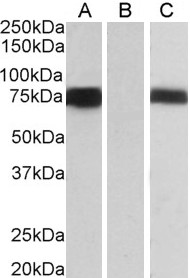 Anti-FOXC1 antibody, C-term used in Western blot. GTX25079