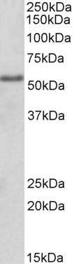 Anti-FOXC1 antibody, Internal used in Western blot. GTX89469