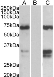 Anti-FOXC2 antibody, C-term used in Western blot. GTX25060