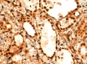 Anti-FOXE1 antibody, C-term used in IHC (Formalin-fixed paraffin-embedded sections). GTX25080