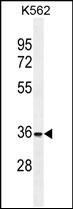 Anti-FOXI3 antibody used in Western blot. GTX53545