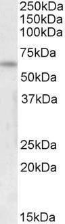 Anti-FOXK2 / ILF (isoform 1) antibody, C-term used in Western blot. GTX25298