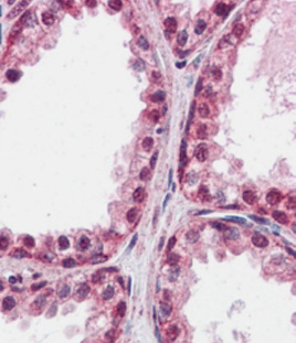 Anti-FOXP2 antibody, Internal used in IHC (Formalin-fixed paraffin-embedded sections). GTX89199