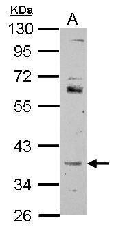 Anti-FOXR2 antibody used in Western blot. GTX117300
