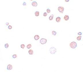 Anti-FREM1 antibody used in ICC/IF. GTX85179