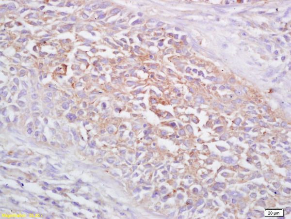 Anti-FRMD6 antibody used in IHC (Formalin-fixed paraffin-embedded sections). GTX51938