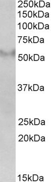 Anti-FSD1 antibody, Internal used in Western blot. GTX89413