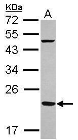Anti-FTMT antibody [N1C3] used in Western blot. GTX117281