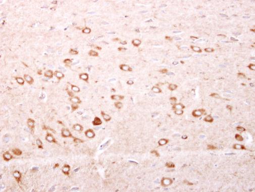 Anti-FTMT antibody [N1C3] used in IHC (Formalin-fixed paraffin-embedded sections). GTX117281