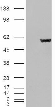 Anti-Fumarate hydratase antibody, Internal used in Western blot. GTX89022