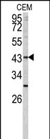 Anti-FUT1 antibody, Internal used in Western blot. GTX81834