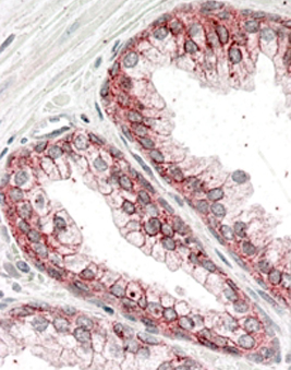 Anti-alpha 1 Catenin antibody, Internal used in IHC (Formalin-fixed paraffin-embedded sections). GTX89347