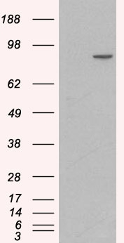 Anti-alpha 1 Catenin antibody, Internal used in Western blot. GTX89347