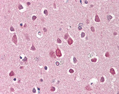 Anti-FXYD2 antibody used in IHC (Formalin-fixed paraffin-embedded sections). GTX108292