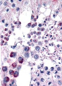 Anti-FZD9 antibody, C-term used in IHC (Formalin-fixed paraffin-embedded sections). GTX88765
