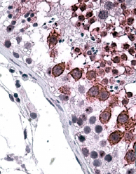Anti-Galanin Receptor 3 antibody, C-term used in IHC (Formalin-fixed paraffin-embedded sections). GTX89373