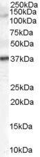Anti-Galanin Receptor 3 antibody, C-term used in Western blot. GTX89373
