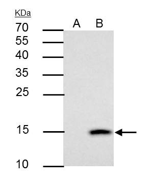Anti-Galectin 7 antibody used in Immunoprecipitation. GTX121475