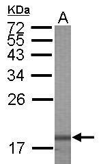 Anti-Galectin 7 antibody used in Western blot. GTX121475