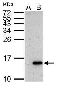 Anti-Galectin 7 antibody used in Western blot. GTX121475