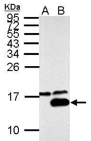 Anti-Galectin 7 antibody used in Western blot. GTX125900