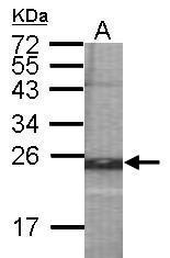 Anti-GALNT5 antibody [C1C3] used in WB-Ag. GTX122621