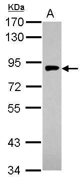 Anti-gamma Adaptin antibody [N1N3] used in Western blot. GTX114244