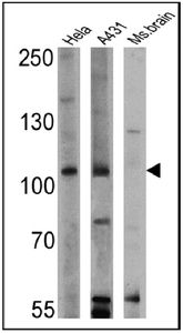 Anti-GAP antibody [B4F8] used in Western blot. GTX22922