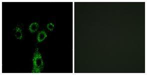 Anti-GASP1 antibody used in ICC/IF. GTX87441