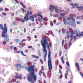 Anti-GBX2 antibody, Internal used in IHC (Formalin-fixed paraffin-embedded sections). GTX89212