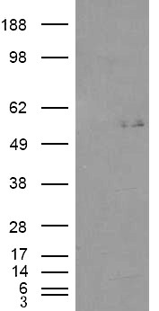 Anti-GCNT3 (aa 273 to 284) antibody, Internal used in Western blot. GTX88861